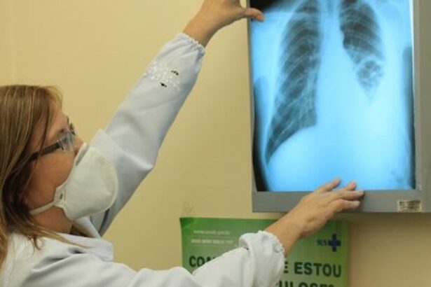 brasil-esta-na-contramao-da-meta-da-oms-para-extincao-da-tuberculose