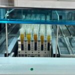 mt-hemocentro-realiza-4,8-mil-exames-para-captacao-de-orgaos-em-12-meses