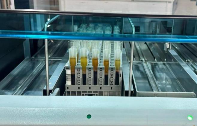 mt-hemocentro-realiza-4,8-mil-exames-para-captacao-de-orgaos-em-12-meses