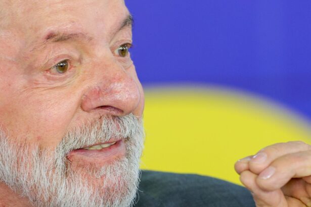 lula-tem-evolucao-satisfatoria-apos-cirurgia-de-catarata